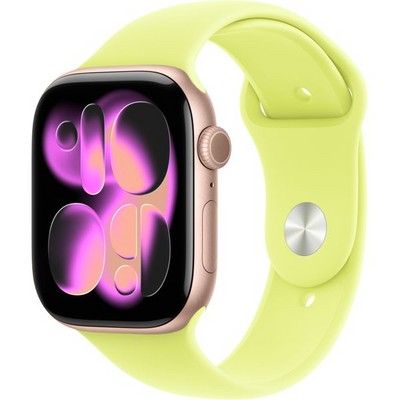 Умные часы Apple Watch Series 11, 46 mm, Rose Gold Aluminium Neon Yellow Sport Band - фото 52014
